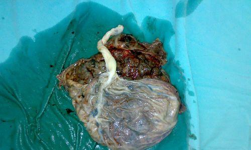 狗胎盘揭秘：结构功能与对狗生命周期的重要影响(图3)