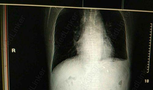 揭秘狗狗便便为什么是黑色的（黑色的狗狗便便究竟是什么引起的？）(图3)