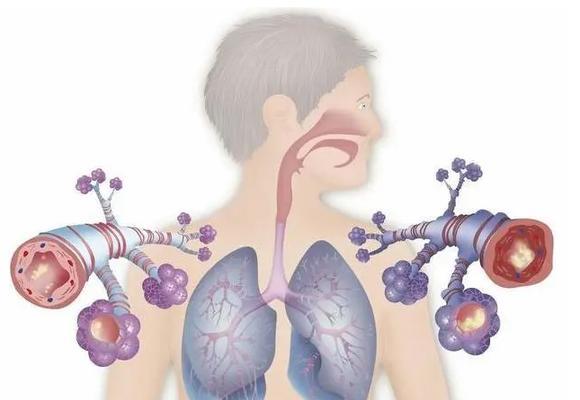 比熊气管炎防治指南:症状、预防与治疗方法详解(图2) 比熊气管炎防治指南:症状、预防与治疗方法详解(图2)