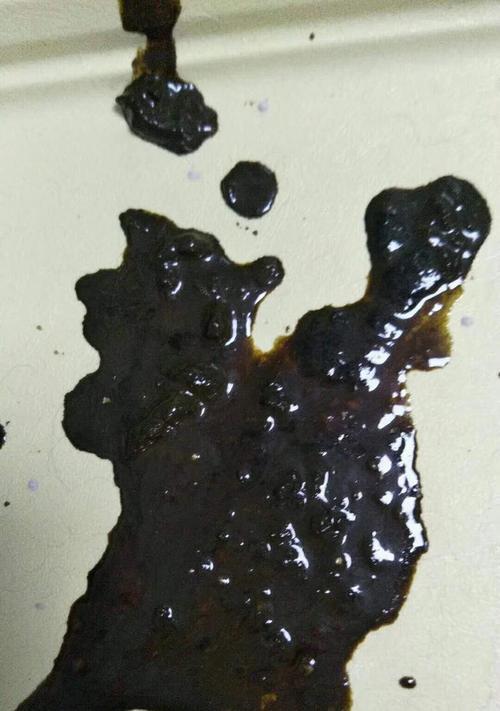 细小早期患者常见便便类型及早期识别指南(图2)