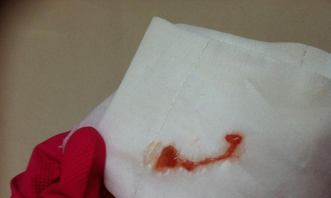 泰迪宠物大便健康指南:识别异常与改善措施(图3) 泰迪宠物大便健康指南:识别异常与改善措施(图3)