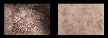 皮肤病为何治愈困难？（探究皮肤病难以治愈的原因及解决方法） - 悠悠酷狗网