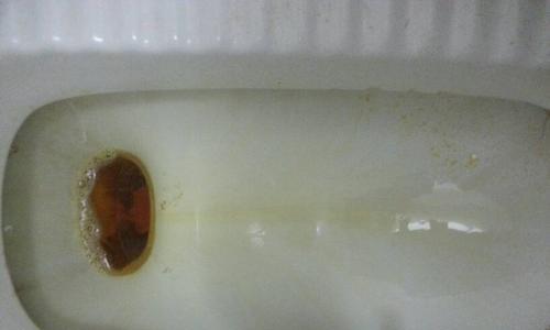 尿液变绿色的原因及其健康含义（探究尿液发绿的可能原因，了解身体健康情况）(图2)