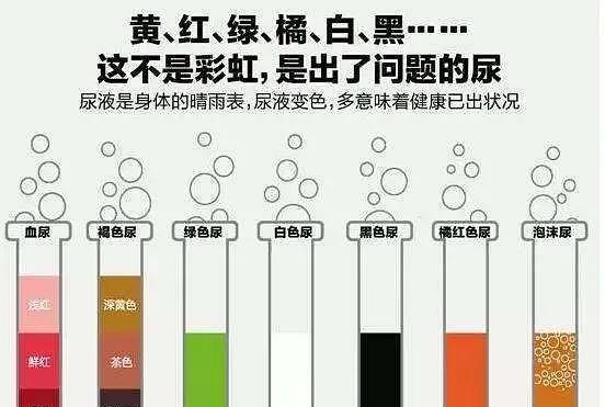 尿液变绿色的原因及其健康含义（探究尿液发绿的可能原因，了解身体健康情况） - 悠悠酷狗网