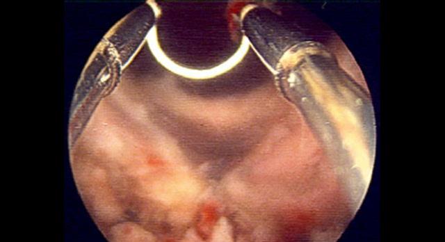 尿液变绿色的原因及其健康含义（探究尿液发绿的可能原因，了解身体健康情况）(图3)