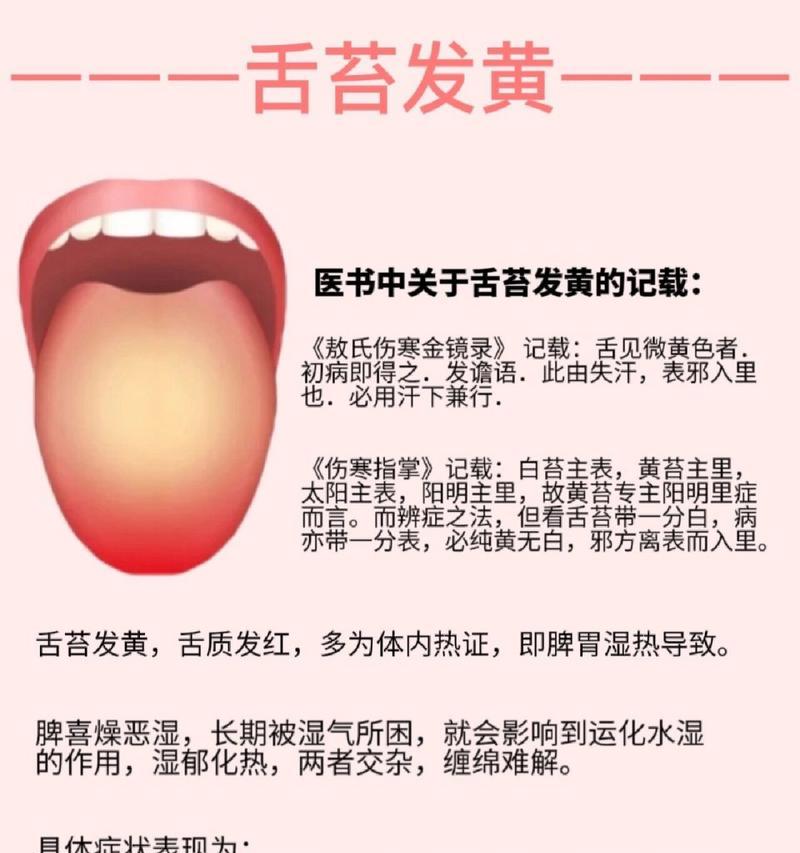 舌苔颜色的意义及影响(舌苔颜色的正常范围及可能的健康问题)(图1) 舌苔颜色的意义及影响(舌苔颜色的正常范围及可能的健康问题)(图1)