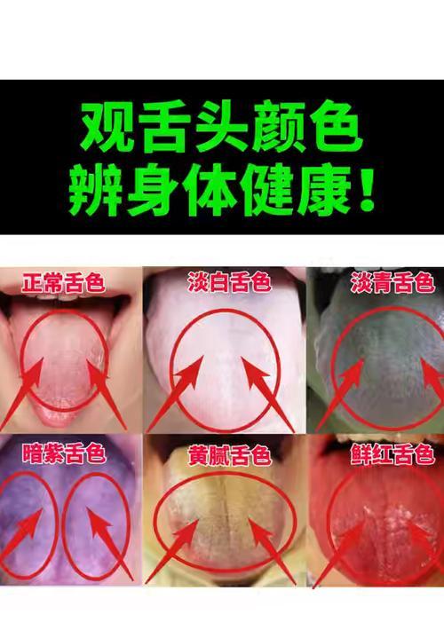 舌苔颜色的意义及影响(舌苔颜色的正常范围及可能的健康问题)(图3) 舌苔颜色的意义及影响(舌苔颜色的正常范围及可能的健康问题)(图3)