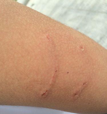 雪纳瑞狗狗狂犬疫苗接种时间解析(了解雪纳瑞狗狗的疫苗接种计划,守护它的健康)(图2) 雪纳瑞狗狗狂犬疫苗接种时间解析(了解雪纳瑞狗狗的疫苗接种计划,守护它的健康)(图2)