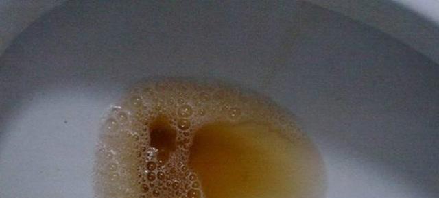 身上气味臭可能是什么病？（探索身体气味异常的潜在疾病及其治疗方法）(图2)