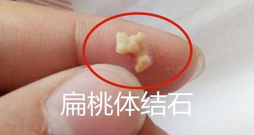 身上气味臭可能是什么病？（探索身体气味异常的潜在疾病及其治疗方法） - 悠悠酷狗网