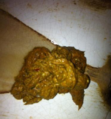 拉大便不成形的原因及处理方法（探讨拉大便不成形的病因和预防措施）(图3)