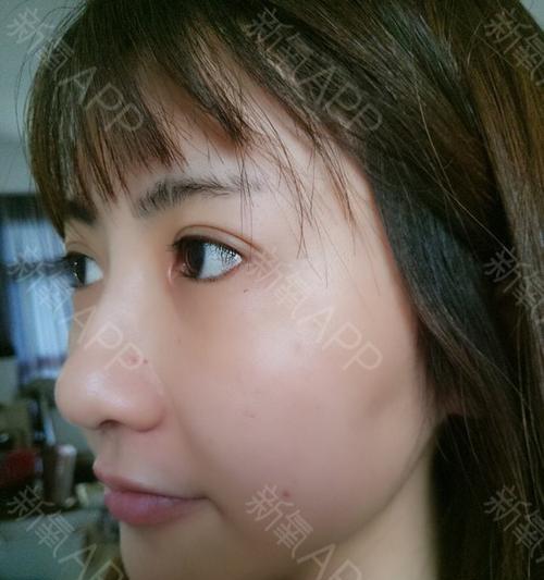 怀孕64天的症状及应对措施（了解怀孕初期的身体变化，做好孕期保健） - 悠悠酷狗网