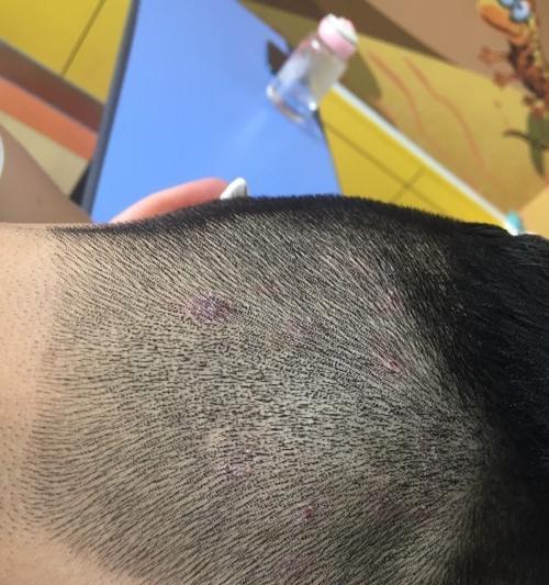 狗狗为何会有头皮屑（头皮屑问题的成因及解决方法）(图3)