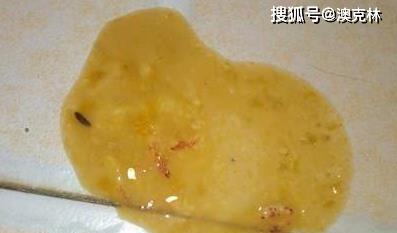 狗罐装病毒防控指南:传播途径与早期症状分析(图3) 狗罐装病毒防控指南:传播途径与早期症状分析(图3)