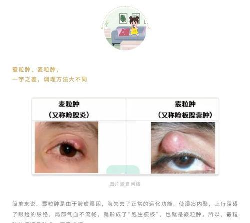 眼屎颜色变化的健康指南及应对方法(图2)