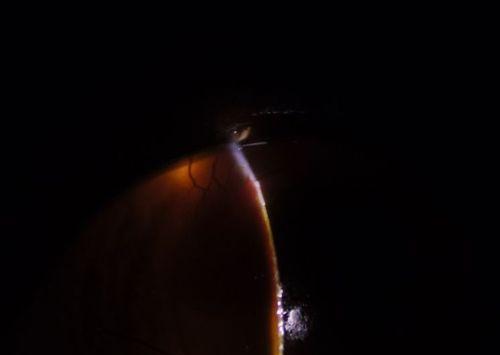 猫眼里的神秘黑黑之谜（解析猫眼中的黑色物质和其意义） - 悠悠酷狗网