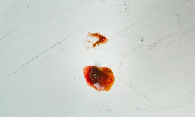 成年狗拉血的原因及处理方法（探究成年狗拉血的可能原因及有效的处理方法）(图1)