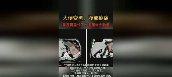 揭秘狗狗便便为什么是黑色的奥秘（黑色便便的成因和健康指示解析）(图3)