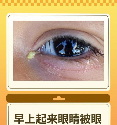 狗眼睛眼屎多的原因及药物治疗方案(揭秘狗眼屎多的真相,告别犬类眼部问题)(图2) 狗眼睛眼屎多的原因及药物治疗方案(揭秘狗眼屎多的真相,告别犬类眼部问题)(图2)