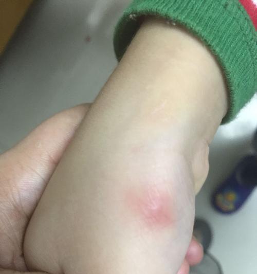 猫猫弓虫病（预防和治疗猫猫弓虫病的重要知识，让你的猫咪远离健康威胁） - 悠悠酷狗网