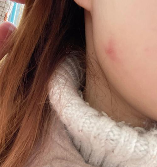 猫咪身上的细菌（探索猫咪身上的常见细菌，保护你和你的宠物的健康）(图1)