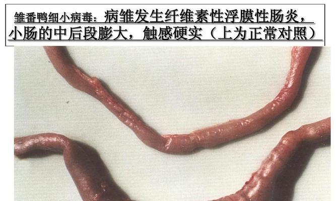 慢性细小症状全面解析(了解慢性细小症状及其治疗关键)(图3) 慢性细小症状全面解析(了解慢性细小症状及其治疗关键)(图3)