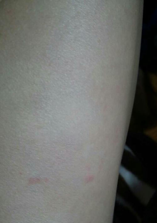 为什么狗狗要咬自己的腿？（探究狗狗咬腿行为的原因和解决方法） - 悠悠酷狗网