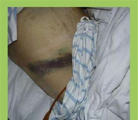 胰头炎的症状（胰头炎的症状是什么？如何预防和治疗？）(图2)