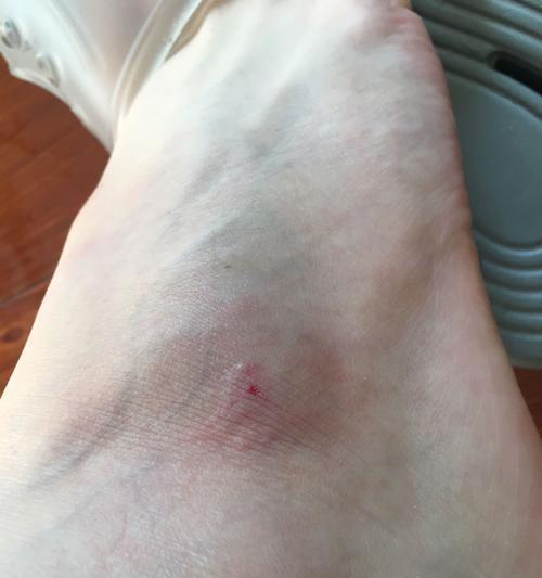 泰迪犬狂犬疫苗接种后的洗澡时间（疫苗注射后多久才能为你的泰迪犬洗澡？）(图1)